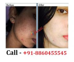 Best Skin Specialist Clinic in Bankata || 8860455545
