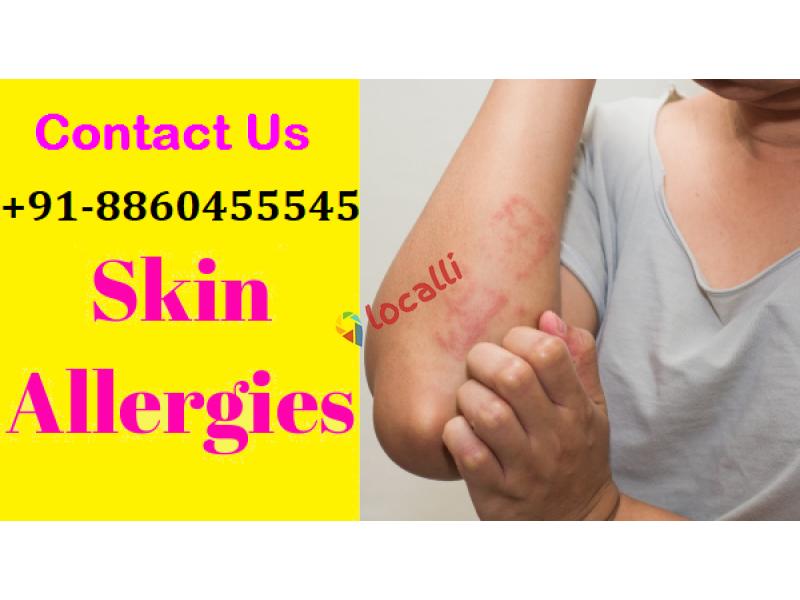 PH :: 8860455545 :: Skin allergy treatment in Majhauli Raj