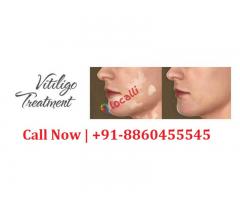 8860455545 : best skin specialist doctor in Ramnath Deoria